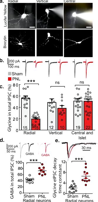 Inhibition of monocarboxylate transporter one in spinal-cord horn signif the behavior nociceptive